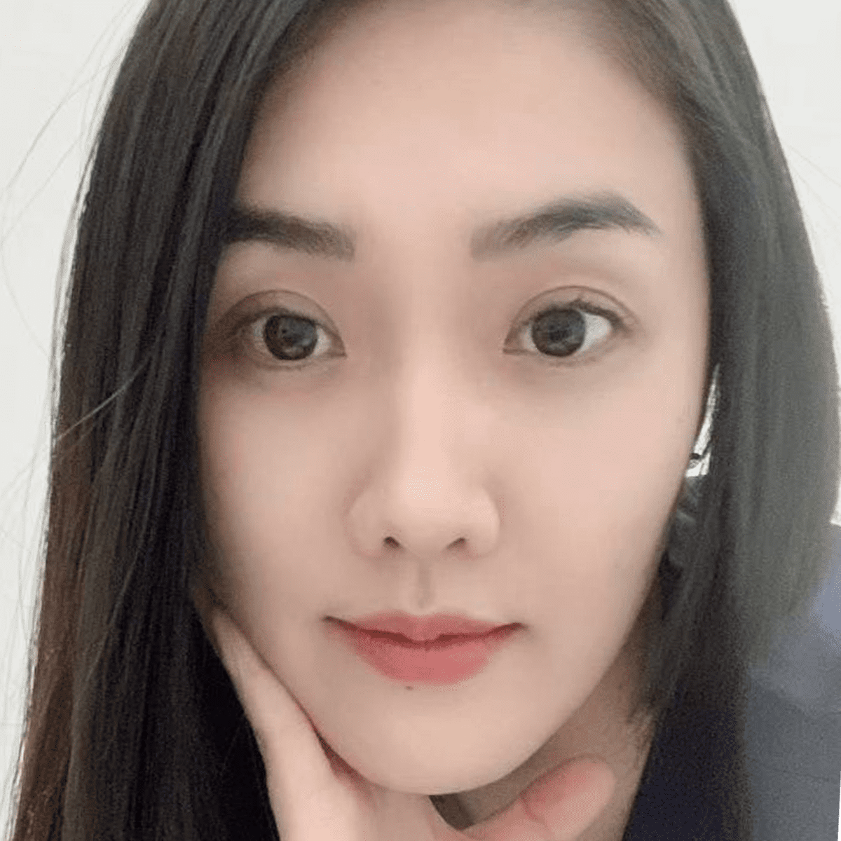 หลังทำ1