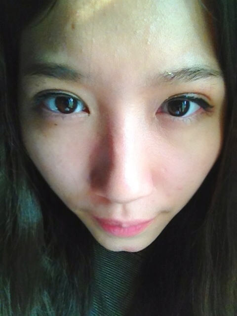 ศัลยกรรมทำตาชั้นเดียว